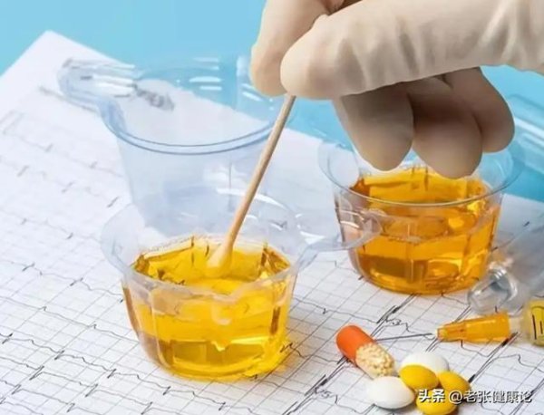 配资公司100强 60岁后还能活多久，看排尿就知？排尿有3习惯，活不久？听分析